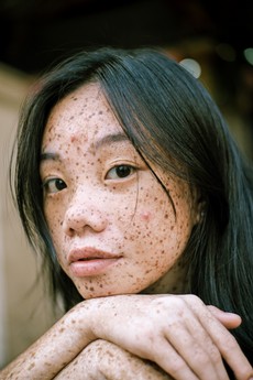 close-up-photography-of-woman-s-face-with-freckles-2709386.jpg